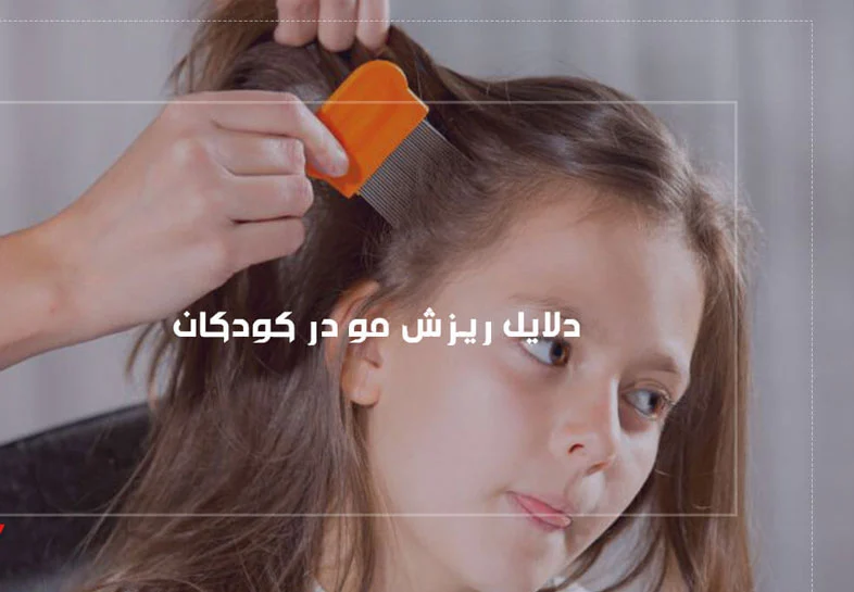ویتامین کمبود چه ویتامینی باعث ریزش مو در کودکان می شود؟