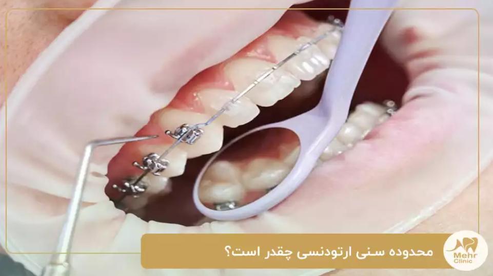 کلینیک دندانپزشکی مهر شریعتی؛ بهترین خدمات ارتودنسی برای تمام محدوده های سنی در تهران