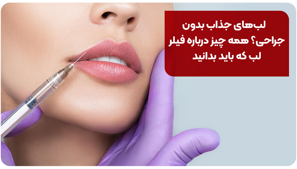 لب های جذاب بدون جراحی؟ همه چیز درباره فیلر لب که باید بدانید