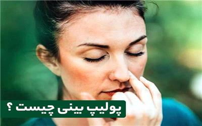 پولیپ بینی چیست و چطور جراحی می شود ؟