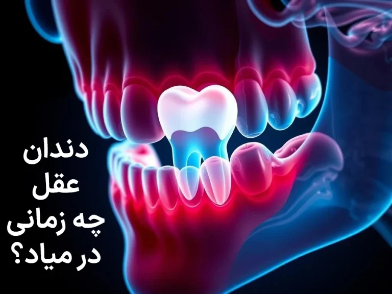 دندان عقل کی در میاد؟